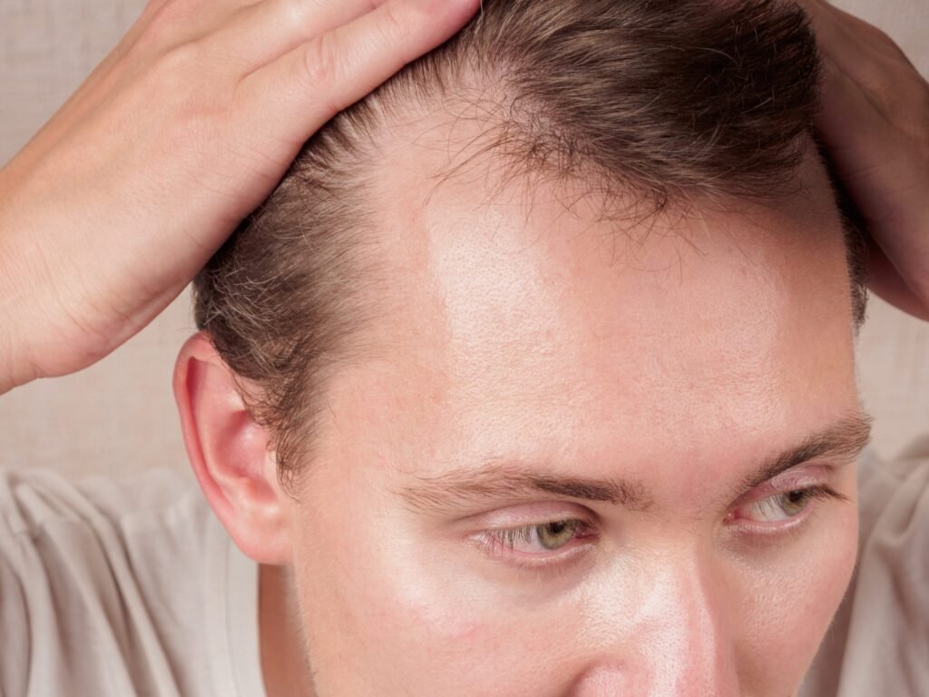 hairline jokes